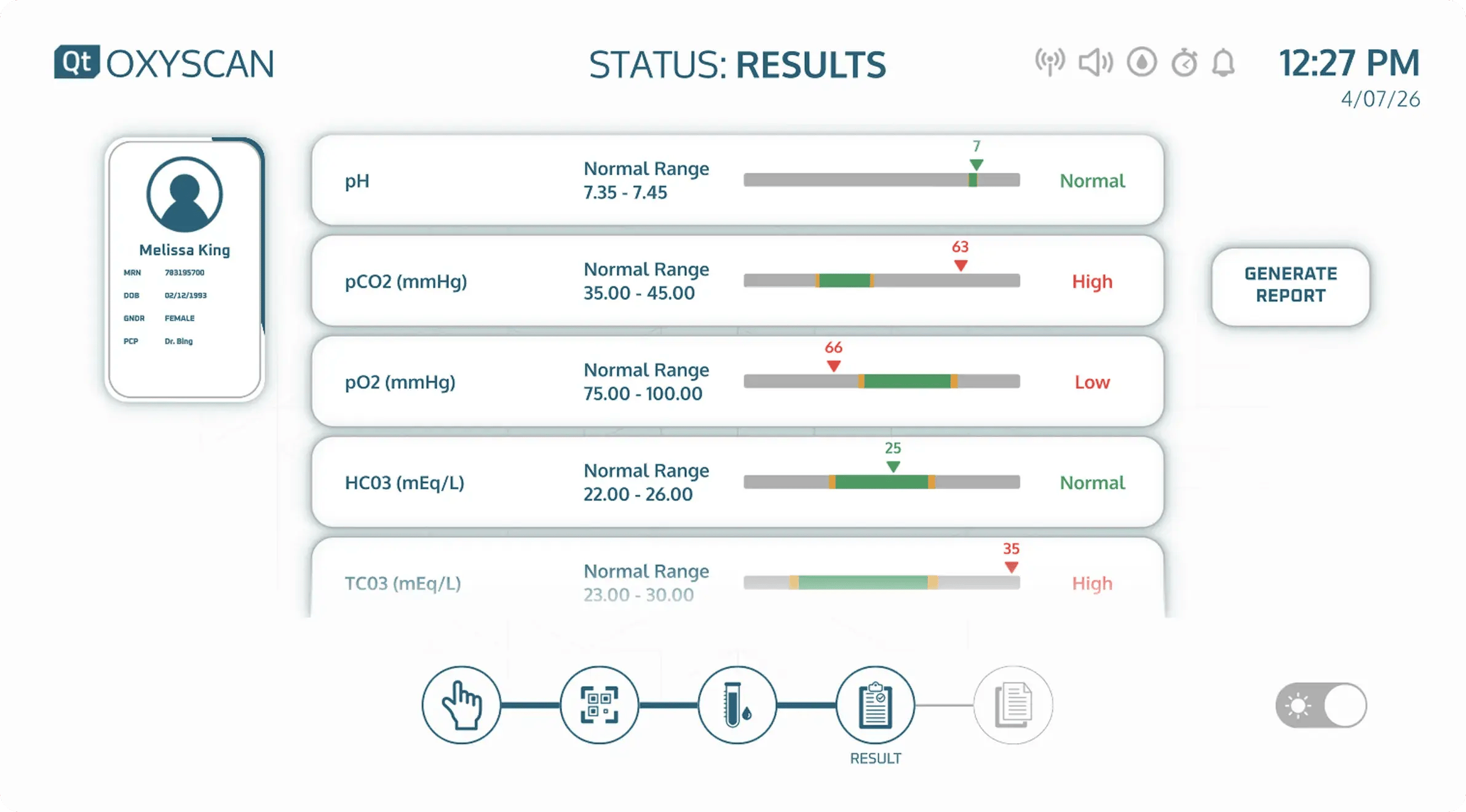 A screen for Oxyscan, a medical device user interface design built with Qt.