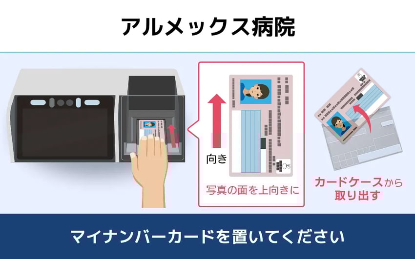 Almex - Mynatouch (New) 2