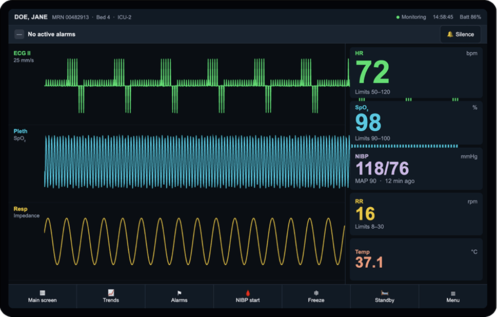 A medical ICU user interface created with a simple prompt in Claude Design and with the help of Qt GUI Design Skill. The interface follows basic medical device UX principles.