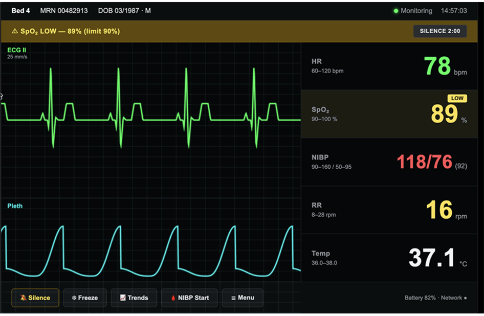 A medical ICU user interface created with a simple prompt in Claude Design. The interface looks good but generic, failing to follow basic medical device UX principles.