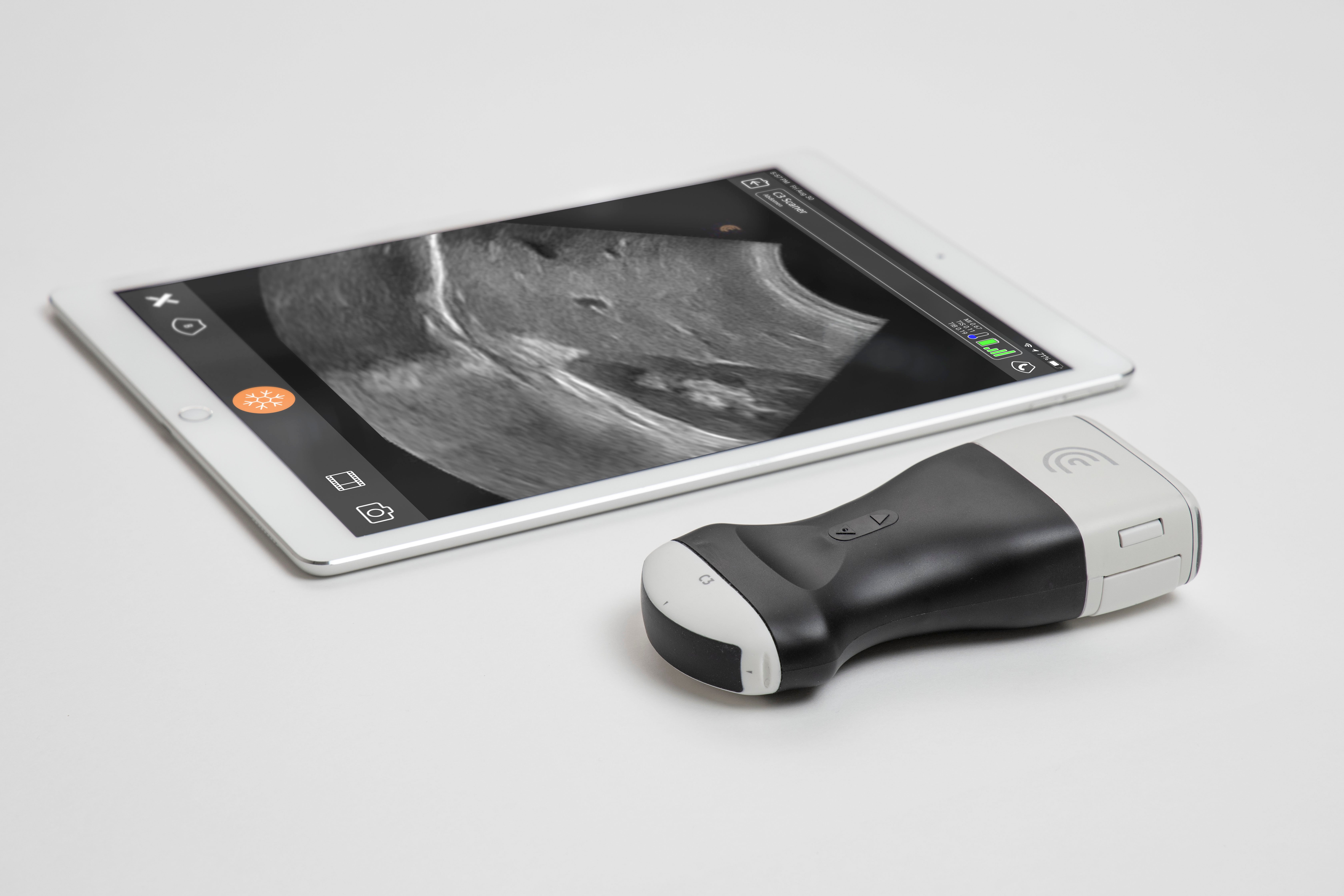 Clarius – Ultra-portable ultrasound scanners Built with Qt